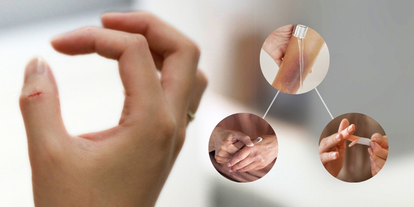 How to Use Pharmacy Essentials to Treat Burns, Cuts & Scrapes Safely 9 Pharmacy essentials to treat cuts and scrapes
